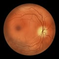 Normal eye retina, illustration