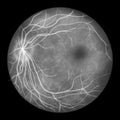 Normal eye retina, scientific illustration Royalty Free Stock Photo