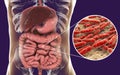 Normal flora of small intestine, bacteria Lactobacillus