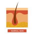 Normal healthy skin structure with body hair