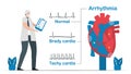 Normal heart signal is compared with 2 types of arrhythmia. It includes tachycardia and bradycardia. Cardiology vector