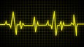 Normal heartbeat line on electrocardiogram (Sinus rhythm). ECG and EKG. indication of life. medical symbol for health