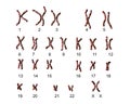 Normal human female karyotype Royalty Free Stock Photo