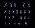 Normal human female karyotype Royalty Free Stock Photo