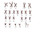 Normal human male karyotype Royalty Free Stock Photo