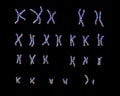 Normal human male karyotype Royalty Free Stock Photo