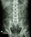 Normal human's lumbosacral spine