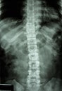 Normal humans thoracic-lumbar spine