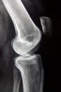 Normal Knee xray Royalty Free Stock Photo