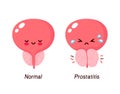 Normal prostate and benign prostatic hyperplasia Royalty Free Stock Photo