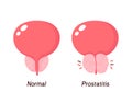 Normal prostate and benign prostatic hyperplasia