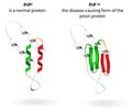 Normal protein and prion diseases. Vector scheme Royalty Free Stock Photo