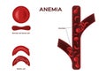 Normal red blood cell and sickle cell vector / anemia