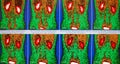 Normal renal flow in red/brown/green