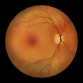 Healthy retina, illustration