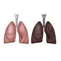 Normal and smoker lungs