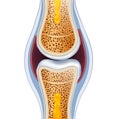 Normal synovial joint anatomy