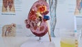 Normal urine hematuria and kidney analysis closeup Royalty Free Stock Photo