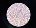 Normalchromic normocytic red blood cell Royalty Free Stock Photo
