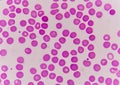 Normochromic normacytic red blood cells