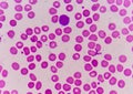 Normochromic normacytic red blood cells Royalty Free Stock Photo