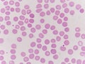 Normochromic normacytic red blood cells Royalty Free Stock Photo