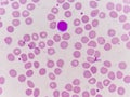 Normochromic normacytic red blood cells Royalty Free Stock Photo
