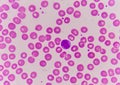 Normochromic normacytic red blood cells Royalty Free Stock Photo