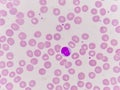 Normochromic normacytic red blood cells Royalty Free Stock Photo