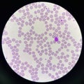 Normochromic and normocytic rbc blood smear Royalty Free Stock Photo