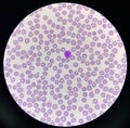Normochromic and normocytic rbc blood smear Royalty Free Stock Photo