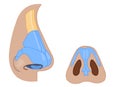 Nose external anatomy