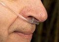 Nose and lips of old man with nasal cannula