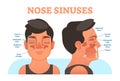 Nose sinuses anatomical vector illustration cross section. Royalty Free Stock Photo