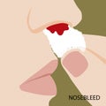 Nosebleeds use a tissue to stop the blood, Illustration in flat design isolated