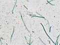 Nostoc sp. algae under microscopic view, cyanobacteria, blue green algae Royalty Free Stock Photo