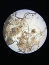 Notoedres cati under the microscope. Notoedric mange, also referred to as Feline scabies