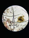 Notoedres cati under the microscope. Notoedric mange, also referred to as Feline scabies