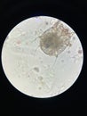 Notoedres cati under the microscope. Notoedric mange, also referred to as Feline scabies