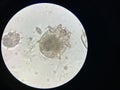 Notoedres cati under the microscope. Notoedric mange, also referred to as Feline scabies