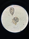 Notoedres cati under the microscope. Notoedric mange, also referred to as Feline scabies