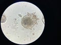 Notoedres cati under the microscope. Notoedric mange, also referred to as Feline scabies