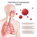 Human MERS-Cov symptoms risk factors. Virus outbreak spread pandemic. Royalty Free Stock Photo