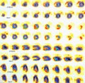 Nuclear myocardial perfusion stress test images