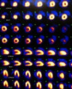 Nuclear myocardial perfusion stress test