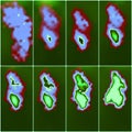 Nuclear renal scan eight images function kidney collage