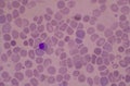 Nucleated Red Blood Cells NRC in blood smear