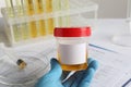 Nurse holding container with urine sample for analysis at table, closeup Royalty Free Stock Photo