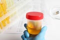 Nurse holding container with urine sample for analysis at table, closeup Royalty Free Stock Photo