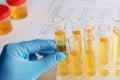 Nurse holding tube with urine sample for analysis at table, closeup Royalty Free Stock Photo